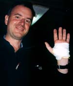 lawrence gets injured